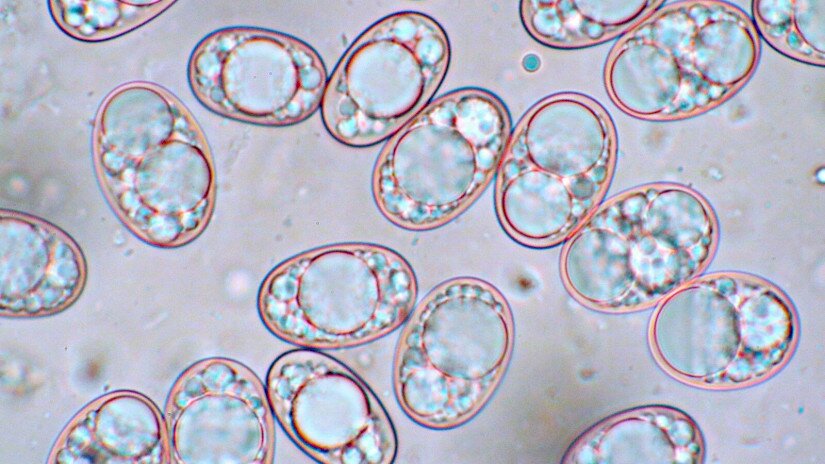 Balsamia sp. - Balzámia faj mikroszkópos spóraképe.