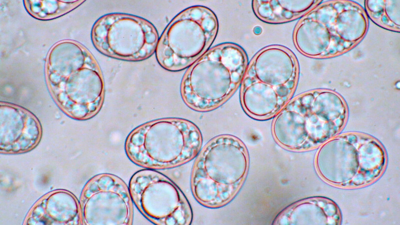 Balsamia sp. - Balzámia faj mikroszkópos spóraképe.