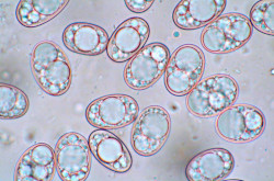 Balsamia sp. - Balzámia faj mikroszkópos spóraképe.